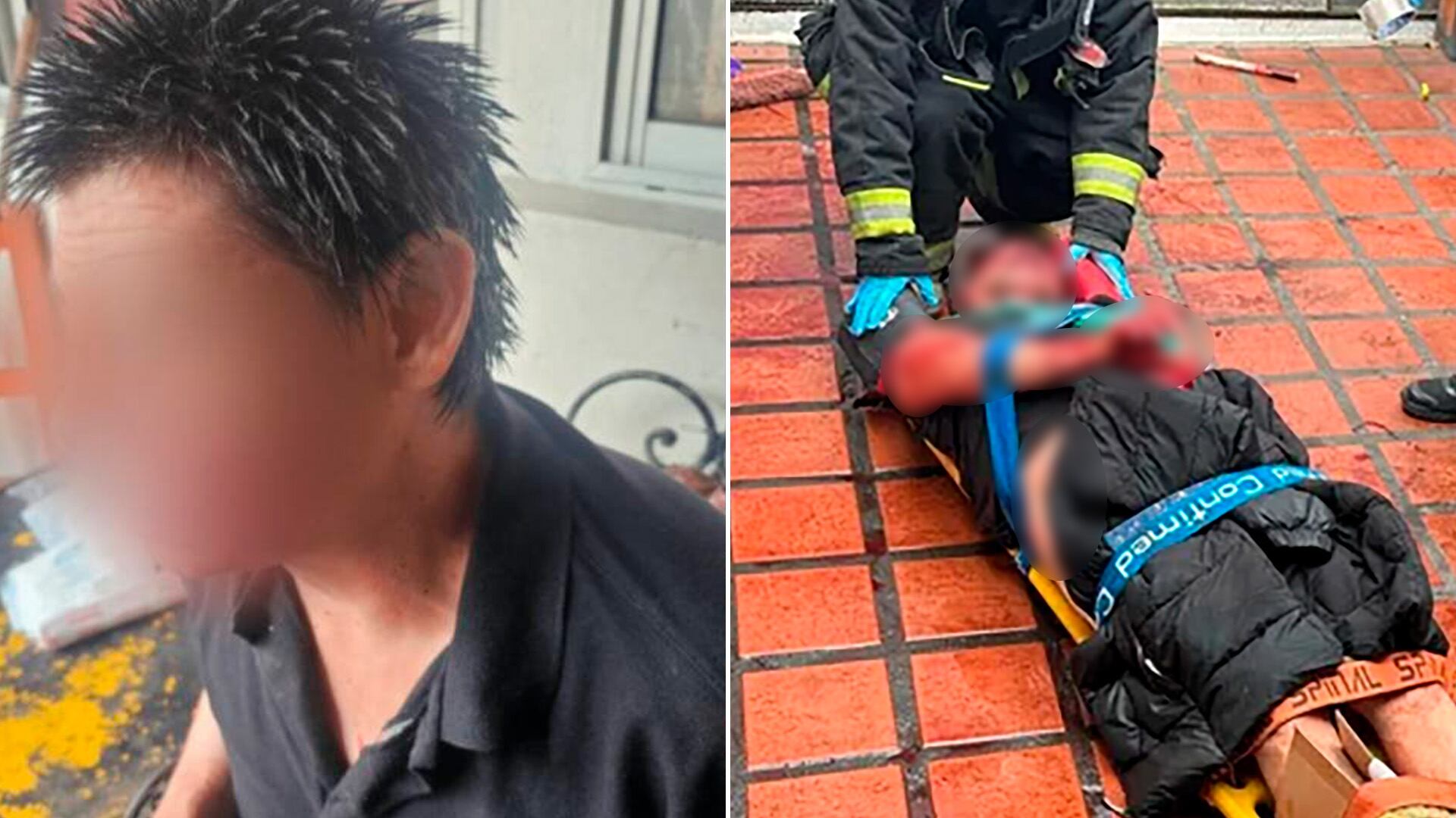 Violenta pelea entre vecinos en La Plata: se enfrentaron a cuchillazos y terminaron con el rostro desfigurado