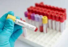 Los casos de sífilis subieron 45% en un año en Tucumán