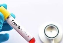 Sífilis en aumento: los casos se incrementaron un 20,5% en el país