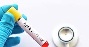 Sífilis en aumento: los casos se incrementaron un 20,5% en el país