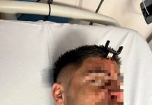 “Por suerte la puedo contar”: habló el futbolista del Ascenso al que le clavaron una llave en la cabeza