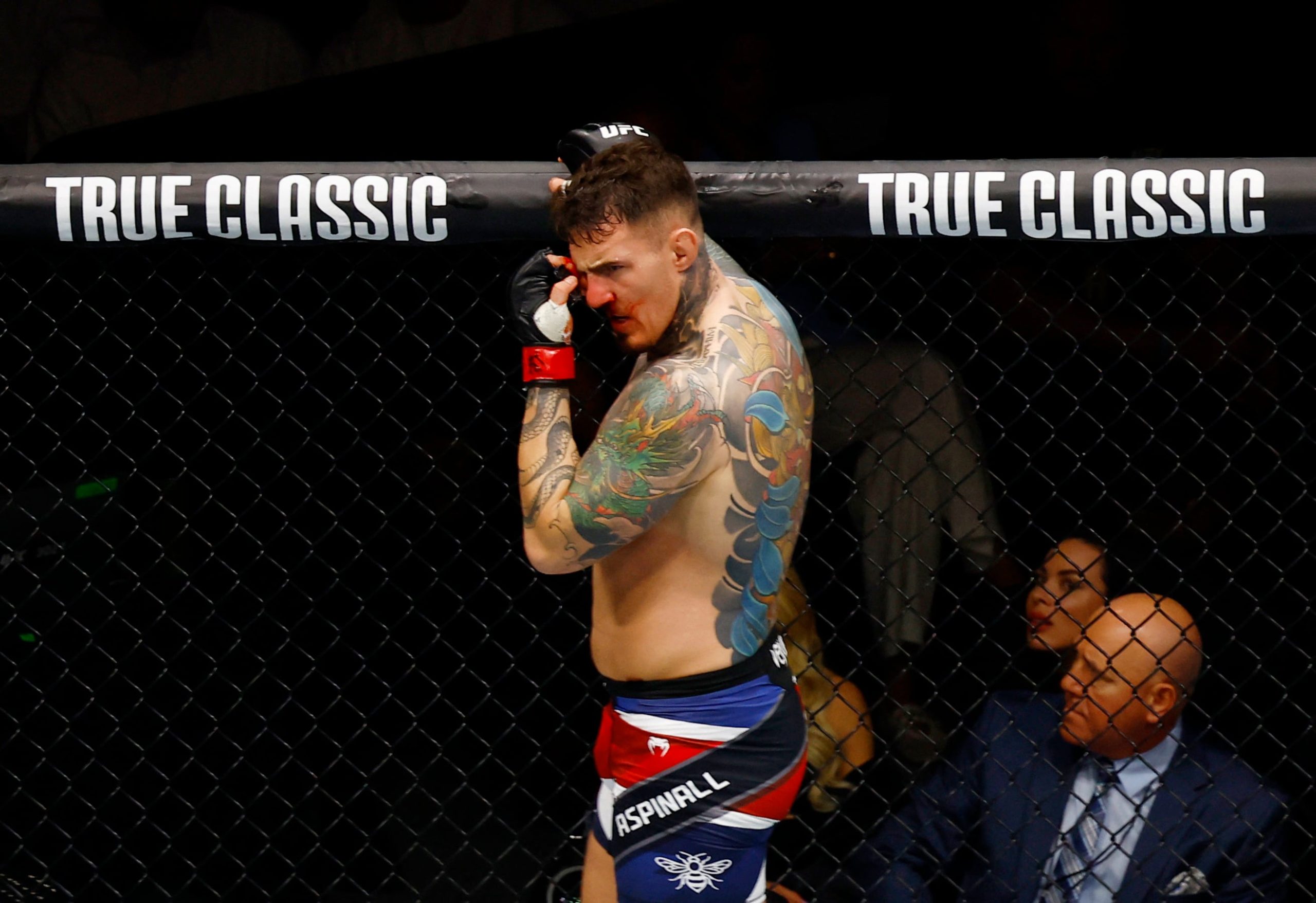 La extraña afección en un ojo que sufre una estrella de la UFC tras recibir un “piquete”