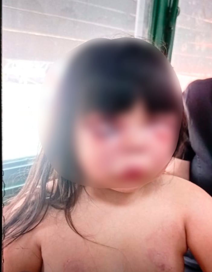 Un hombre le desfiguró la cara a golpes a una nena de 7 años, atacó a la madre y fue detenido por vecinos en Gerli
