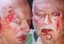 Violenta entradera en Mar del Plata: un grupo de delincuentes atacó a golpes y le robó a una pareja de jubilados